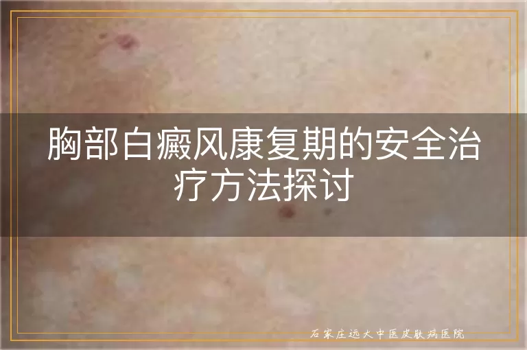 胸部白癜风康复期的安全治疗方法探讨