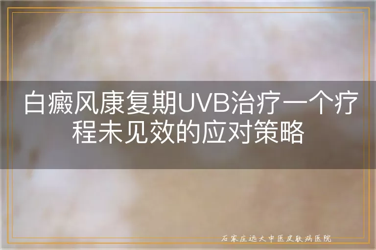 白癜风康复期UVB治疗一个疗程未见效的应对策略
