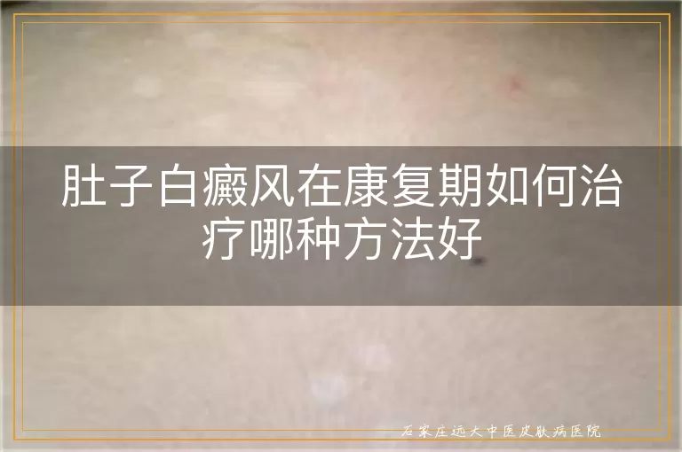 肚子白癜风在康复期如何治疗哪种方法好
