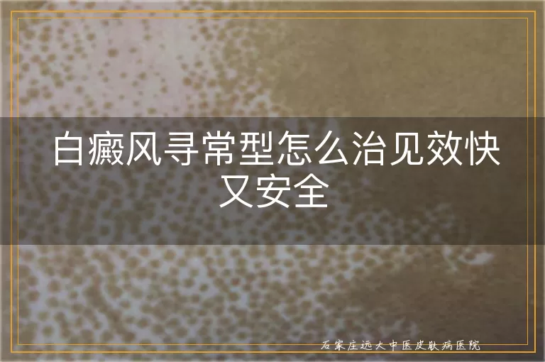 白癜风寻常型怎么治见效快又安全