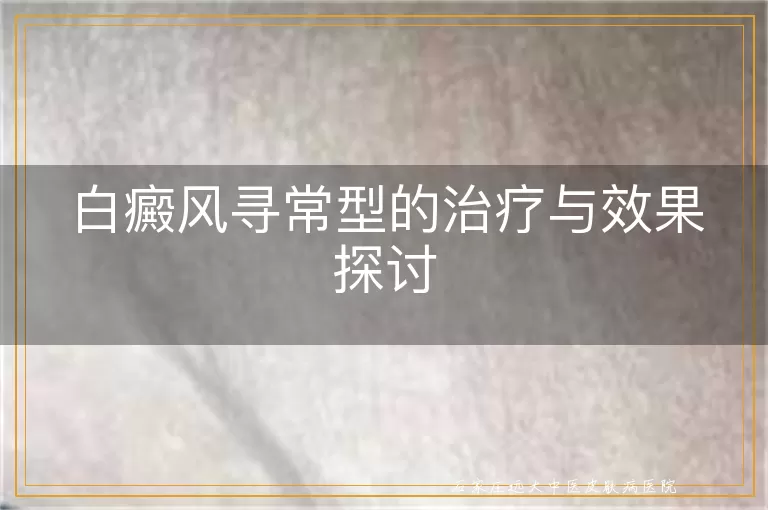白癜风寻常型的治疗与效果探讨