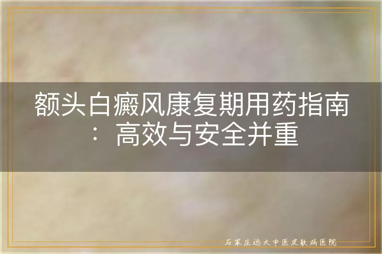 额头白癜风康复期用药指南：高效与安全并重