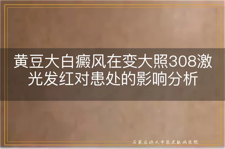 黄豆大白癜风在变大照308激光发红对患处的影响分析