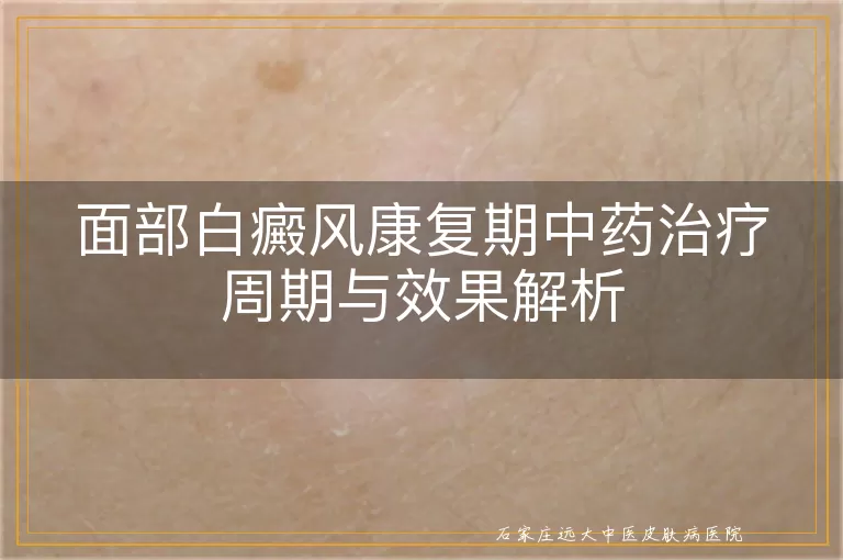 面部白癜风康复期中药治疗周期与效果解析