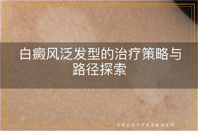 白癜风泛发型的治疗策略与路径探索