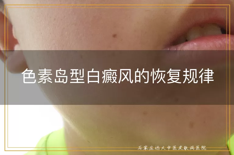 色素岛型白癜风的恢复规律