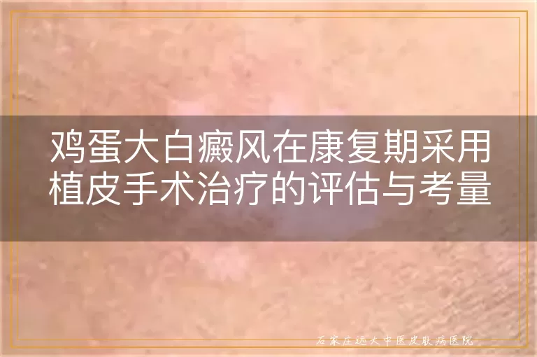 鸡蛋大白癜风在康复期采用植皮手术治疗的评估与考量