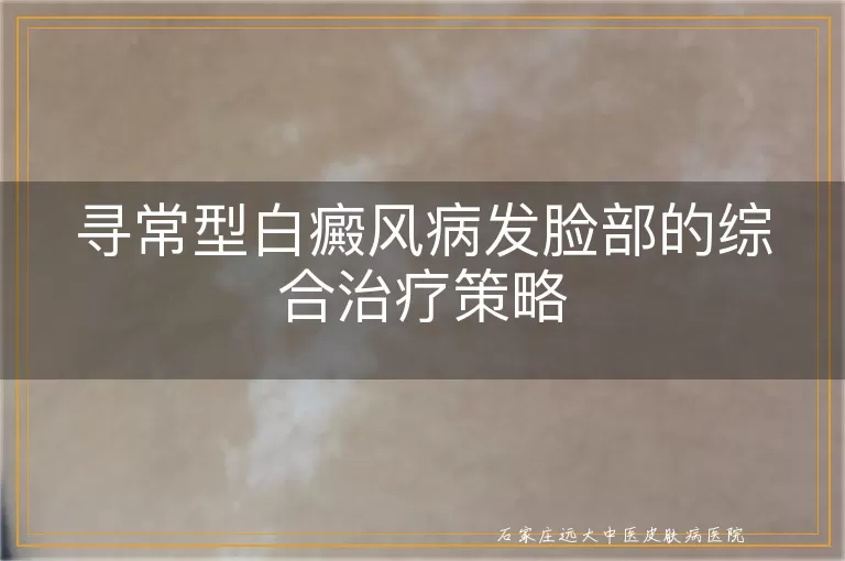 寻常型白癜风病发脸部的综合治疗策略