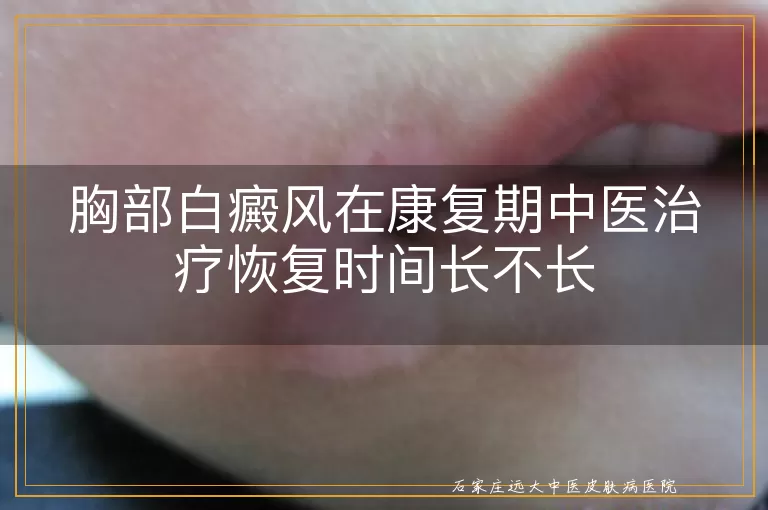 胸部白癜风在康复期中医治疗恢复时间长不长