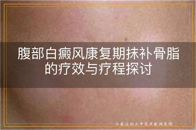 腹部白癜风康复期抹补骨脂的疗效与疗程探讨