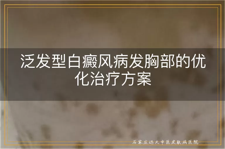 泛发型白癜风病发胸部的优化治疗方案
