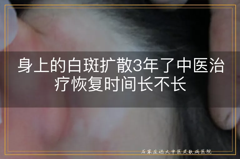 身上的白斑扩散3年了中医治疗恢复时间长不长