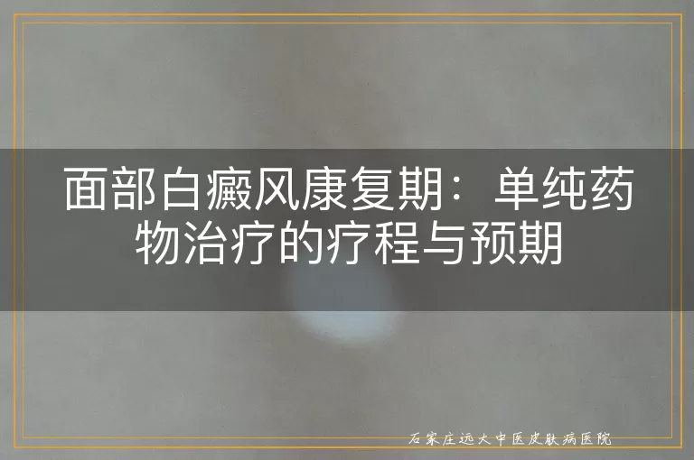 面部白癜风康复期：单纯药物治疗的疗程与预期