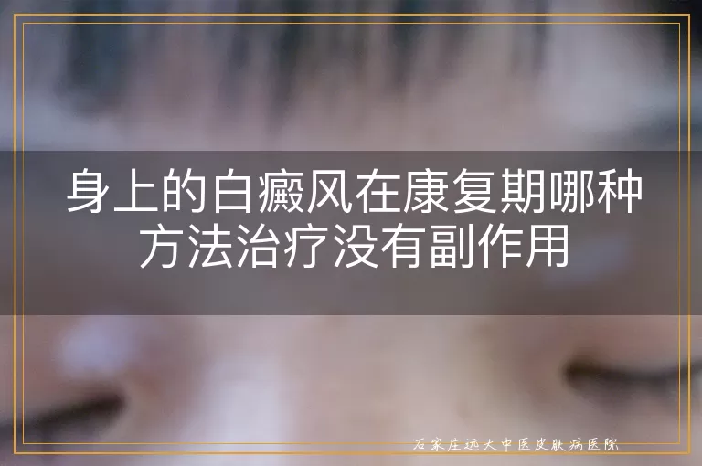 身上的白癜风在康复期哪种方法治疗没有副作用