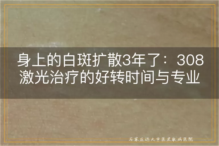 身上的白斑扩散3年了：308激光治疗的好转时间与专业解析