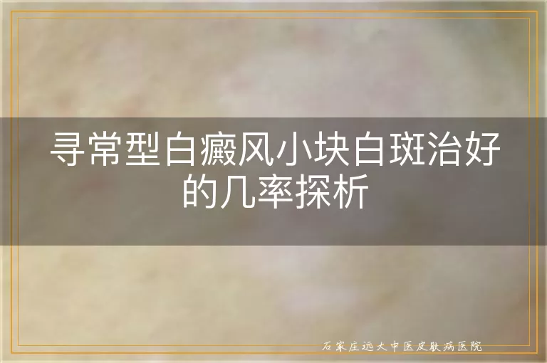 寻常型白癜风小块白斑治好的几率探析