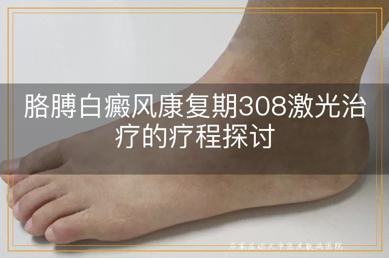 胳膊白癜风康复期308激光治疗的疗程探讨