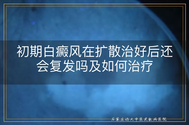 初期白癜风在扩散治好后还会复发吗及如何治疗