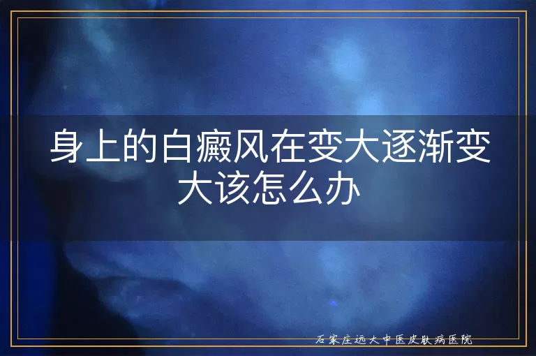 身上的白癜风在变大逐渐变大该怎么办