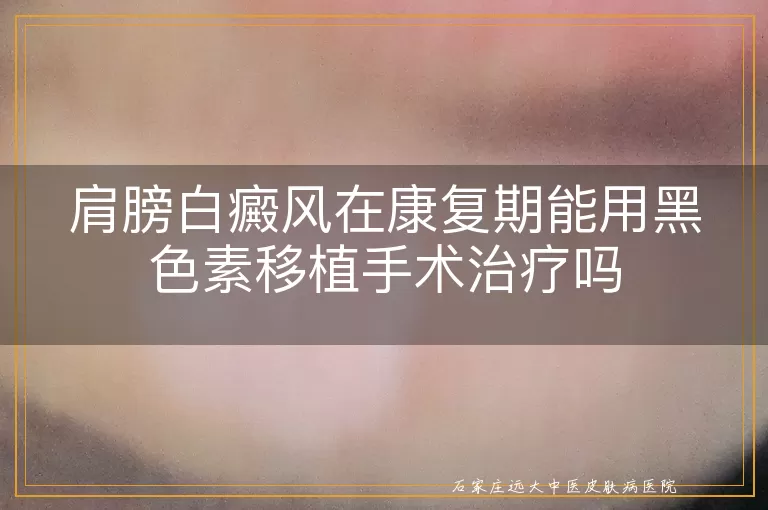 肩膀白癜风在康复期能用黑色素移植手术治疗吗