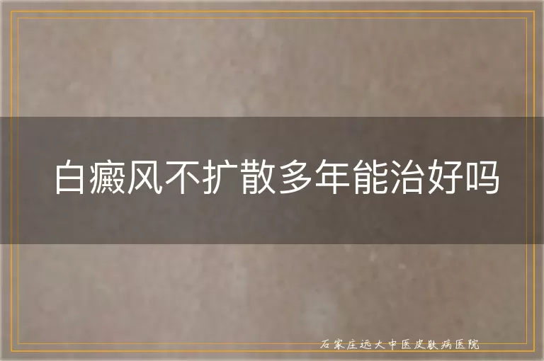 白癜风不扩散多年能治好吗