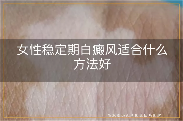女性稳定期白癜风适合什么方法好
