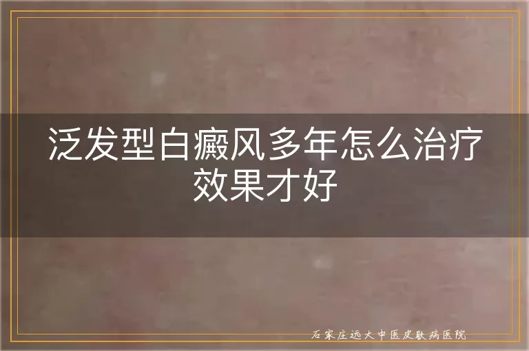泛发型白癜风多年怎么治疗效果才好