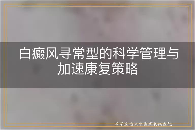 白癜风寻常型的科学管理与加速康复策略