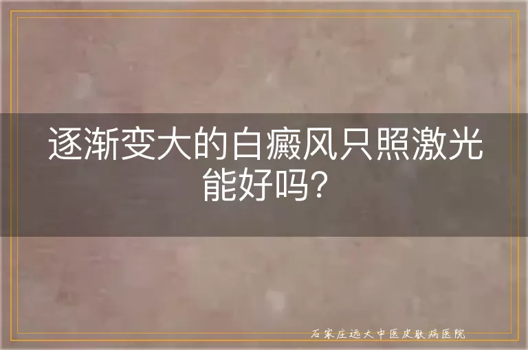 逐渐变大的白癜风只照激光能好吗？