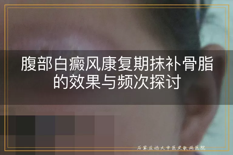 腹部白癜风康复期抹补骨脂的效果与频次探讨