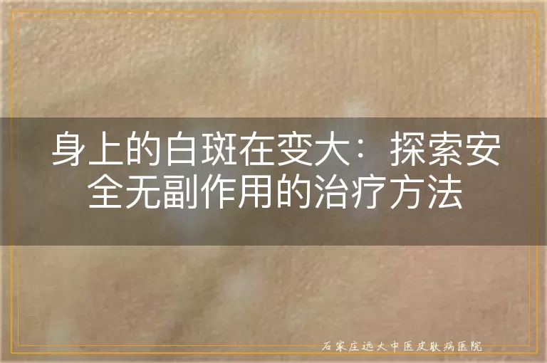 身上的白斑在变大：探索安全无副作用的治疗方法