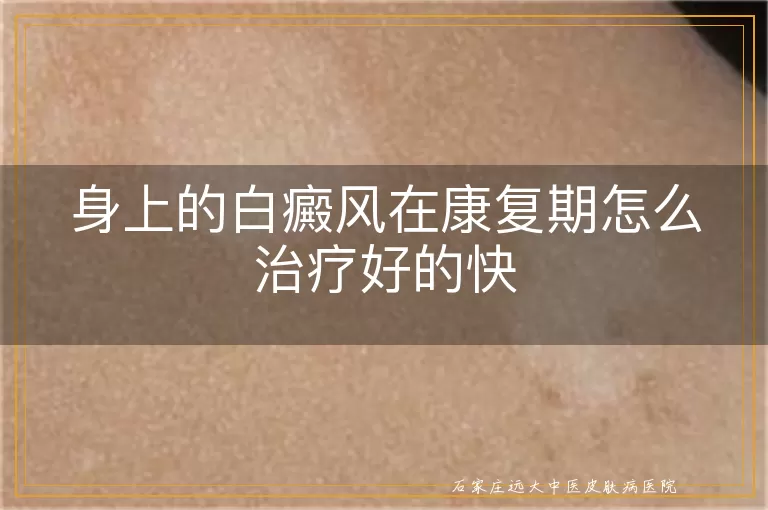 身上的白癜风在康复期怎么治疗好的快