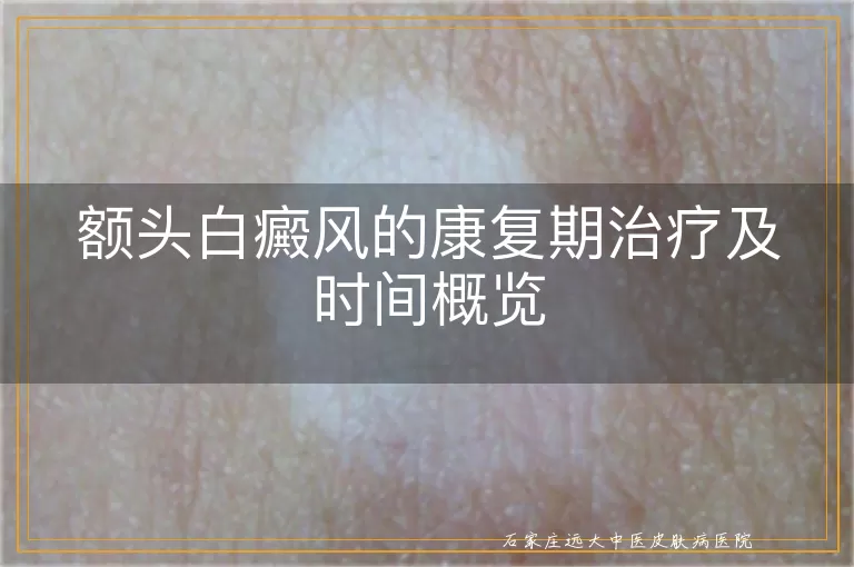 额头白癜风的康复期治疗及时间概览