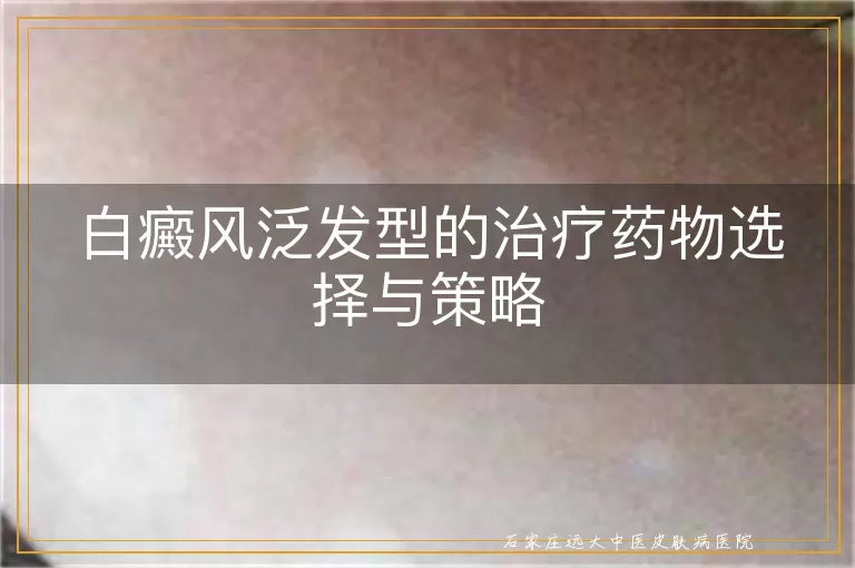 白癜风泛发型的治疗药物选择与策略