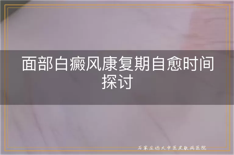 面部白癜风康复期自愈时间探讨