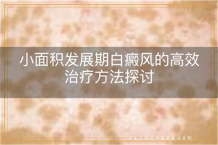 小面积发展期白癜风的高效治疗方法探讨