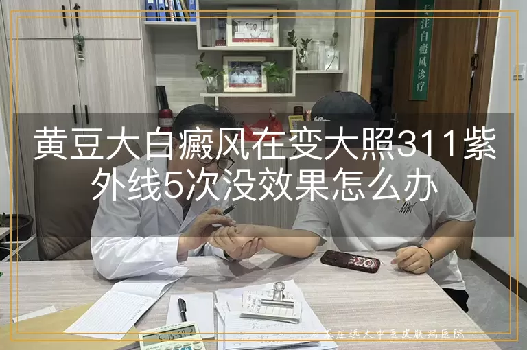 黄豆大白癜风在变大照311紫外线5次没效果怎么办