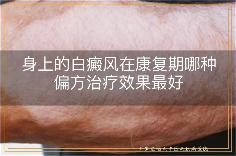 身上的白癜风在康复期哪种偏方治疗效果最好
