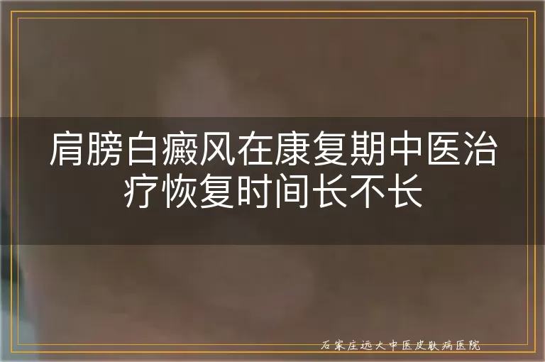 肩膀白癜风在康复期中医治疗恢复时间长不长