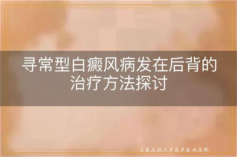 寻常型白癜风病发在后背的治疗方法探讨