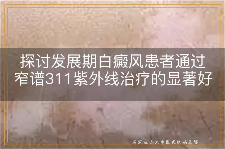 探讨发展期白癜风患者通过窄谱311紫外线治疗的显著好转案例