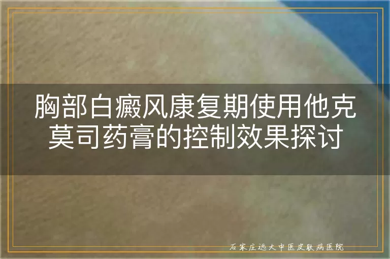胸部白癜风康复期使用他克莫司药膏的控制效果探讨