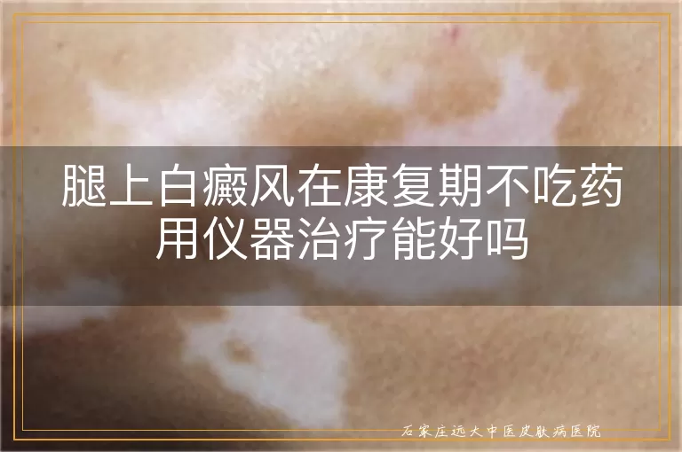 腿上白癜风在康复期不吃药用仪器治疗能好吗