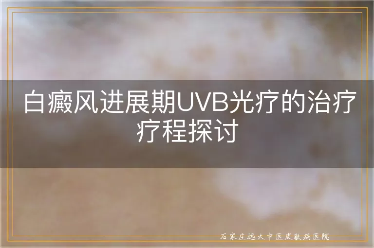 白癜风进展期UVB光疗的治疗疗程探讨