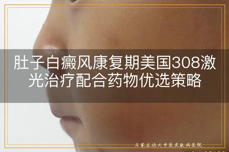 肚子白癜风康复期美国308激光治疗配合药物优选策略