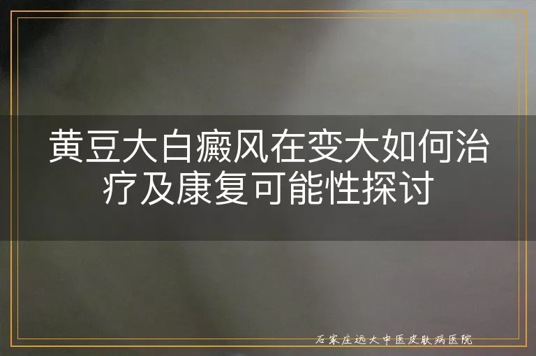 黄豆大白癜风在变大如何治疗及康复可能性探讨