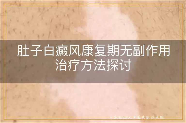 肚子白癜风康复期无副作用治疗方法探讨