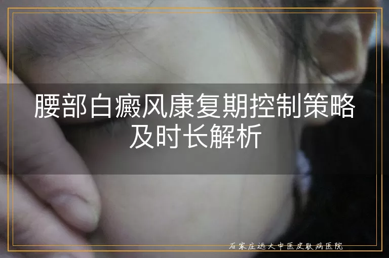 腰部白癜风康复期控制策略及时长解析