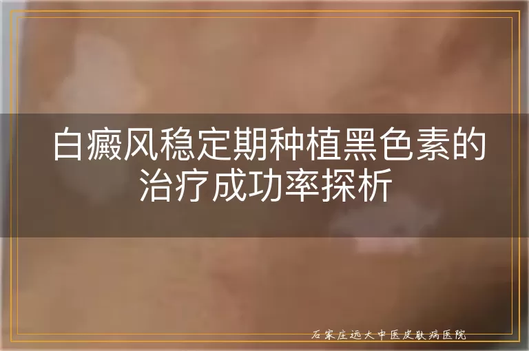 白癜风稳定期种植黑色素的治疗成功率探析