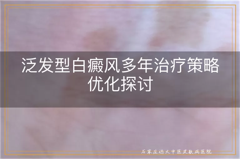 泛发型白癜风多年治疗策略优化探讨